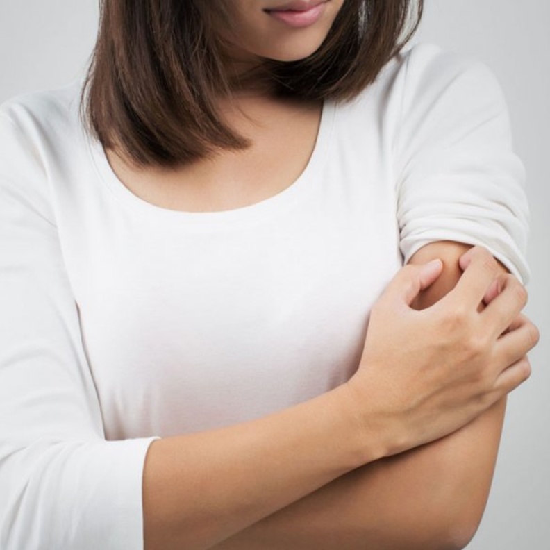 الوراثة تؤثر في الإصابة بمرض الصدفية