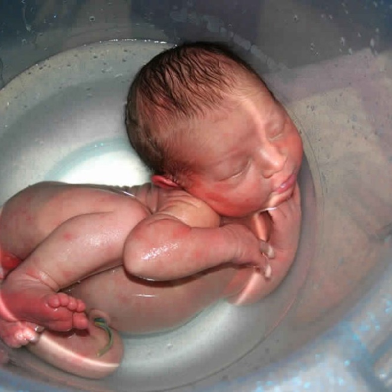 شروط الولادة تحت الماء وما هي فوائدها ومخاطرها