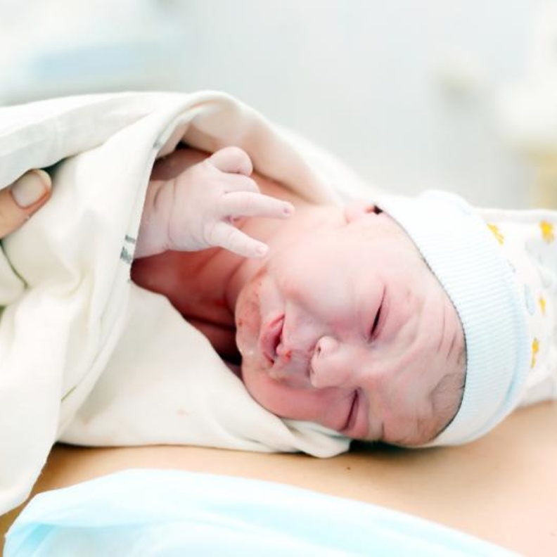 ولادة طفل حامل في شقيقه التوأم