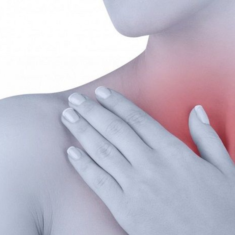  زيادة إفراز المعدة لحمض الهيدروكروليك يسبب الحموضة