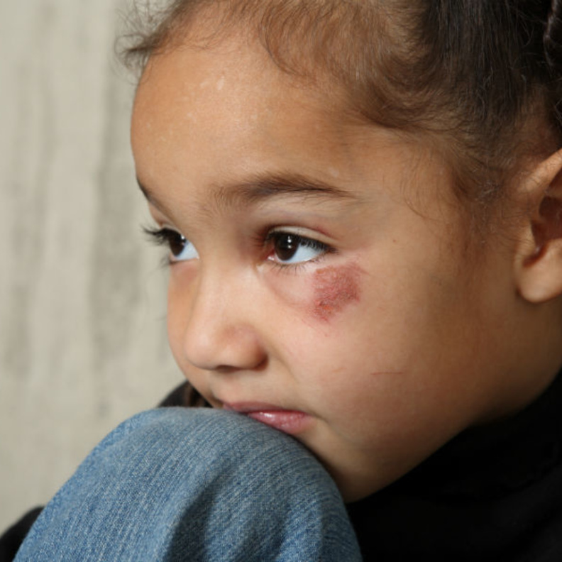 ضرب الأطفال يعلمهم أن الأخطاء شيء ممكن.