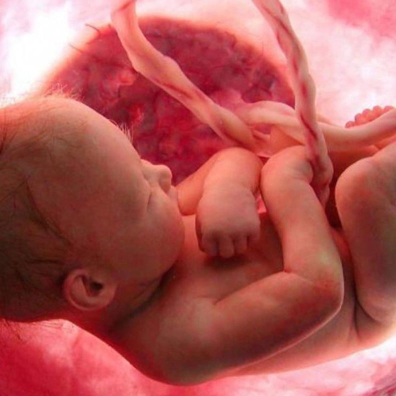 التقزم عند الاطفال هو صغر حجم الأطراف عند الطفل 