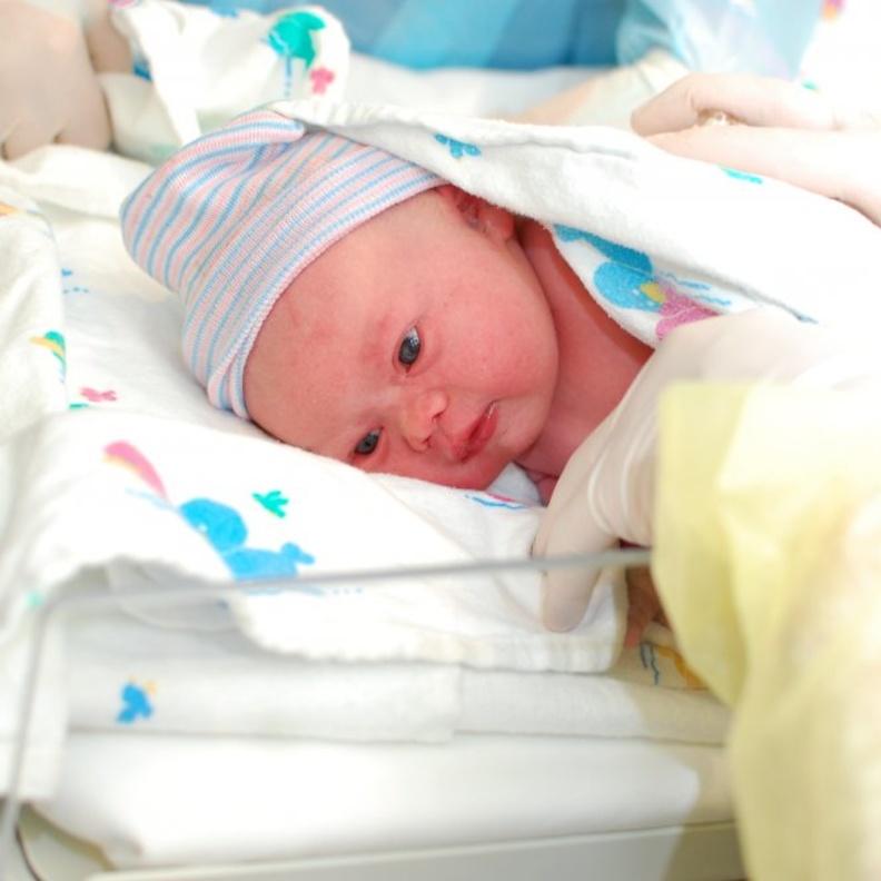 ملامح الوجه توضح اعراض متلازمة داون عند حديثي الولادة