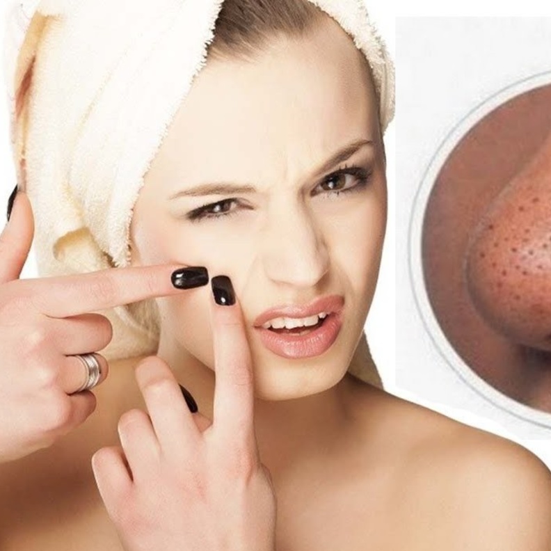 عقمي اصابعك قبل الضغط على الرؤوس السوداء