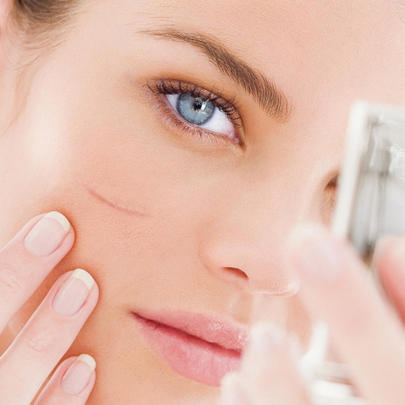 جربي هذه الوصفات الطبيعية للتخلص من آثار الجروح