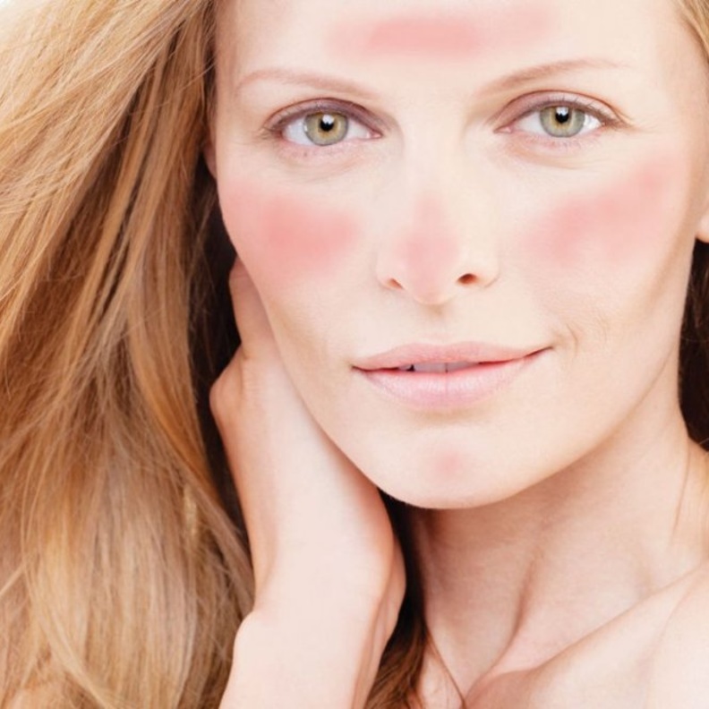 يفضل عدم حك الجلد أثنا حساسية الجلد