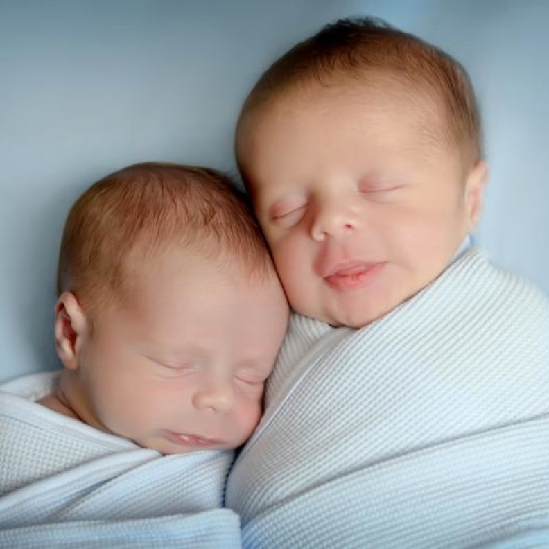 طفل يُولد حاملاً في اخيه التوأم 