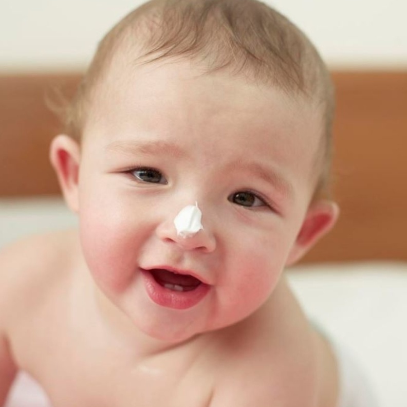 الاكزيما البنيوية