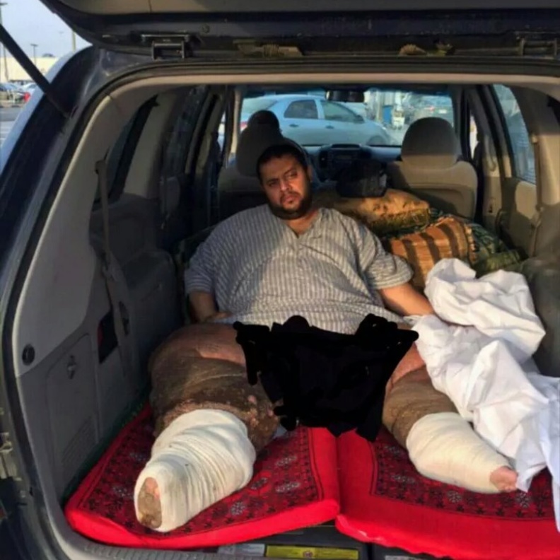  المريض تركي الغامدي