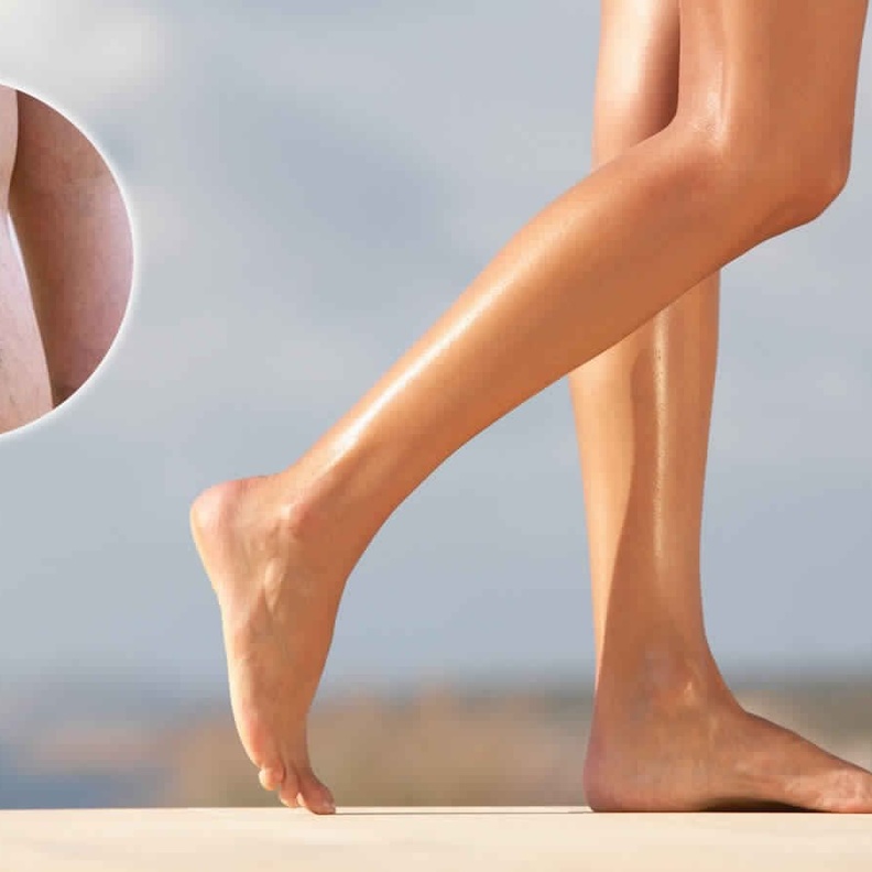 رياضة رفع الاقدام وتقليل الوزن تقي من دوالي الساقين