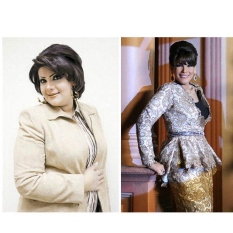  الهام الفضالة قبل وبعد خسارة الوزن