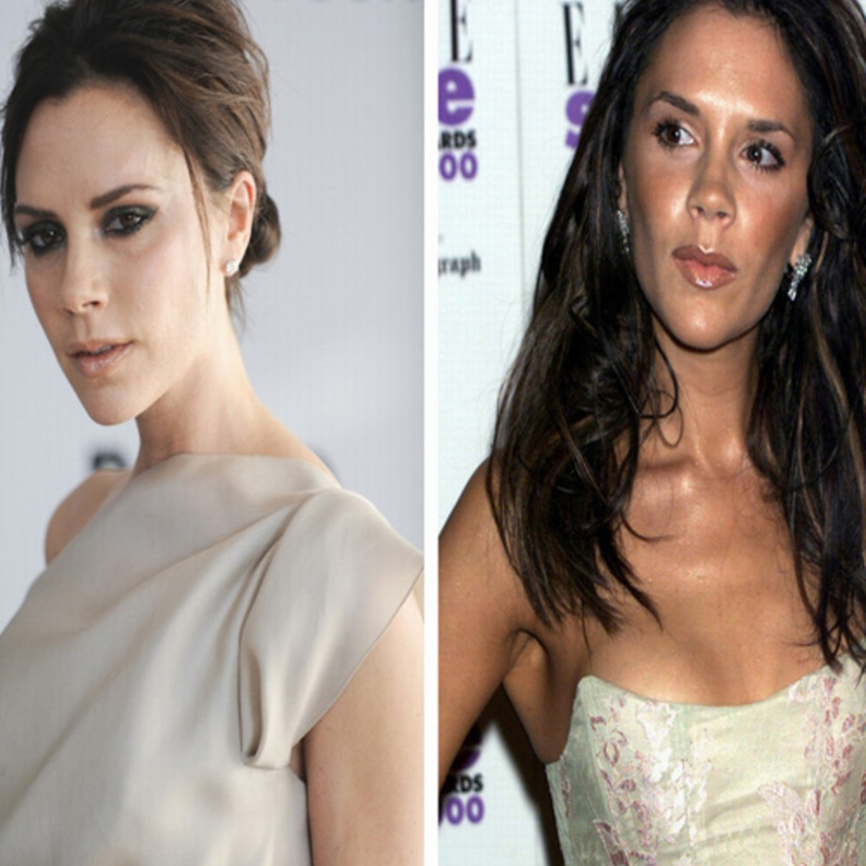  ليل كيم قبل وبعد