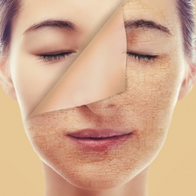 تخلصي من بشرتك الجافة بالعناية الدائمة