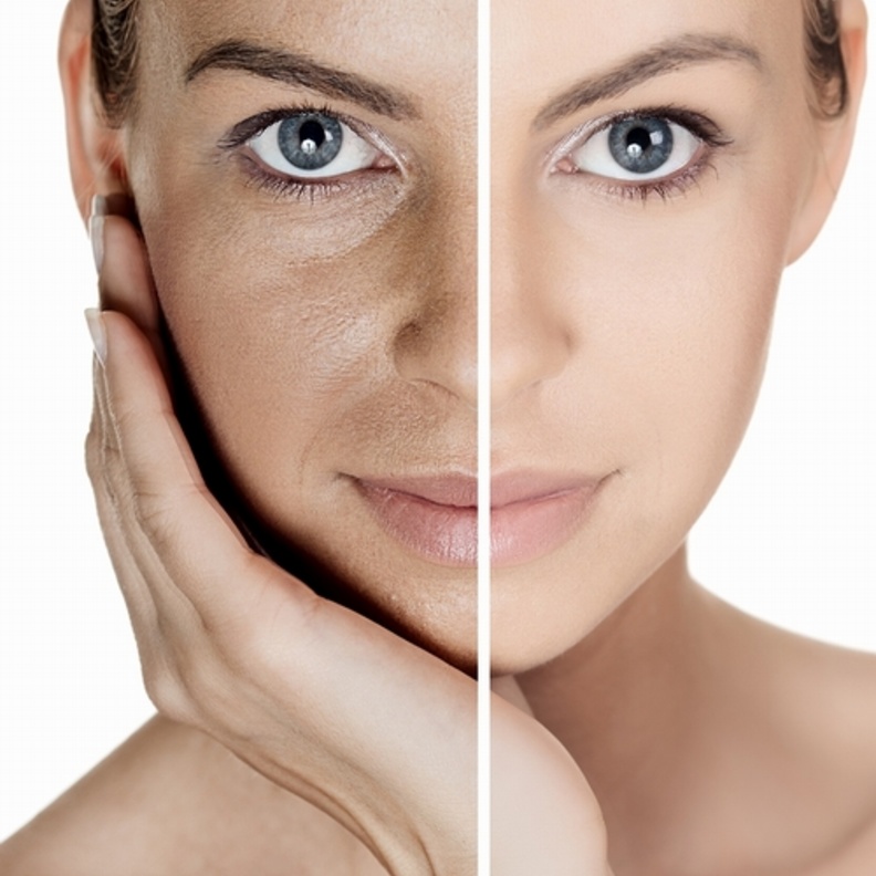 تخلصي من مشاكل البشرة و الهالات السوداء مع زيت اللوز 