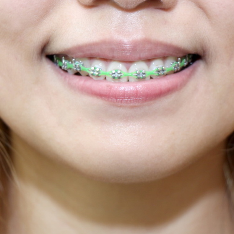 عيادات الاسنان تحرص على جلب أحدث الأجهزة