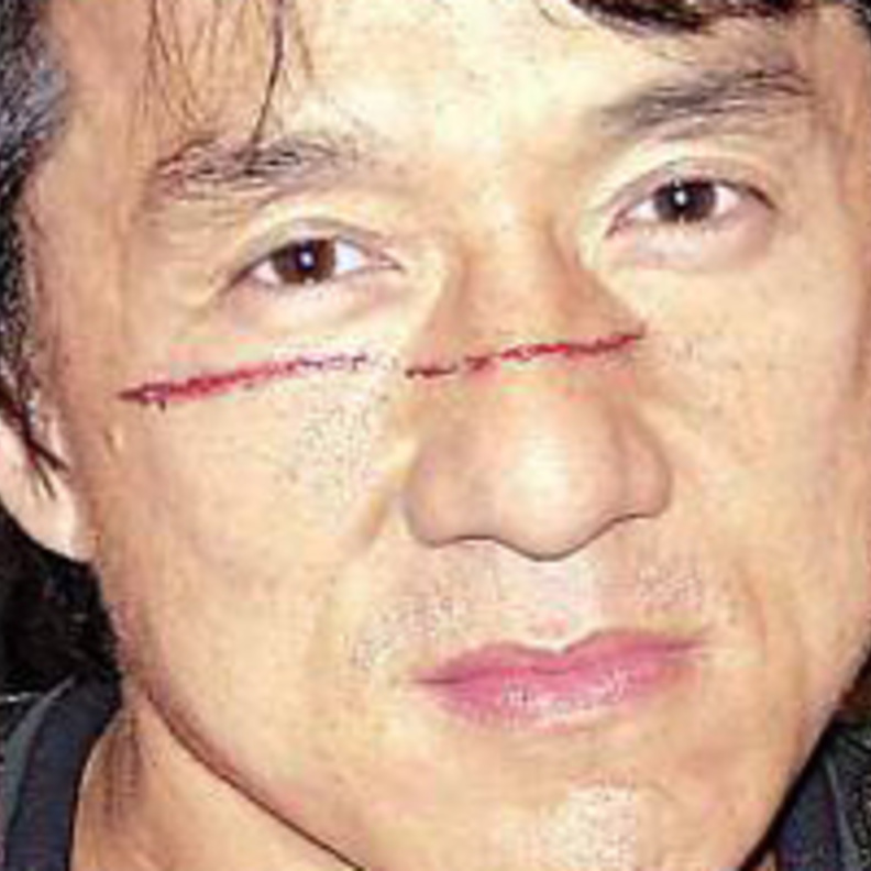 جاكي شان مصابا