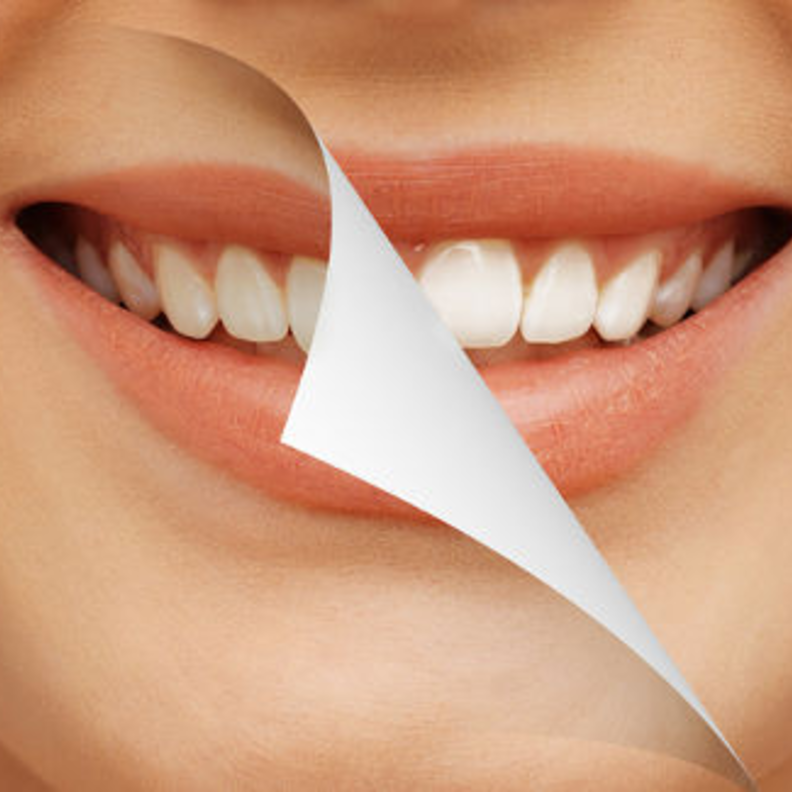 الحفاظ على نظافة الأسنان يحميها من تغير اللون