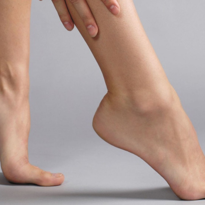 دوالي الساقين يمكن علاجها بالرياضه و الغذاء المناسب