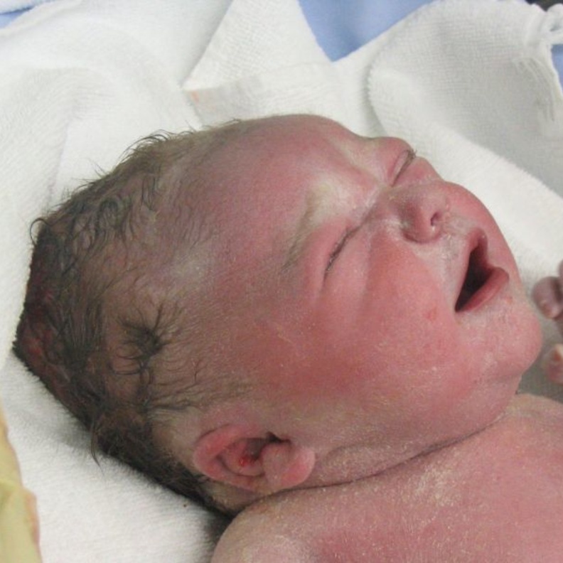 ضرب الطفل على ظهره بعد الولادة  