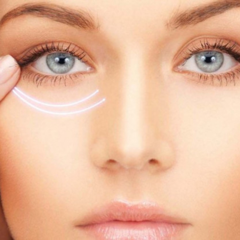 علاج الهالات السوداء بخلطة سحرية مذهلة