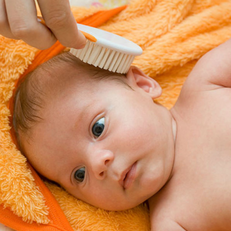علاج قشرة الشعر عند الأطفال الرضع