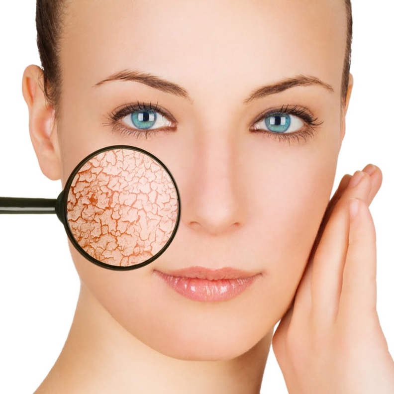 فصل الشتاء يفاقم مشكلة جفاف البشرة