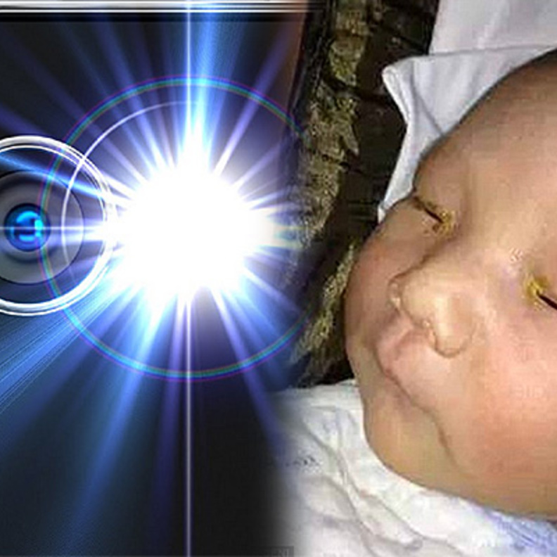 رضيع يصاب بعمى كامل في عينه بسبب ضوء فلاش الكاميرا!