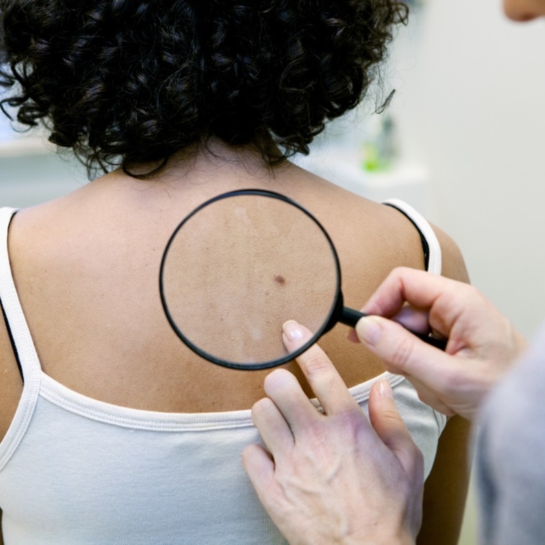 ما زال العلاج المناعي لسرطان الجلد غير نافع بالمطلق