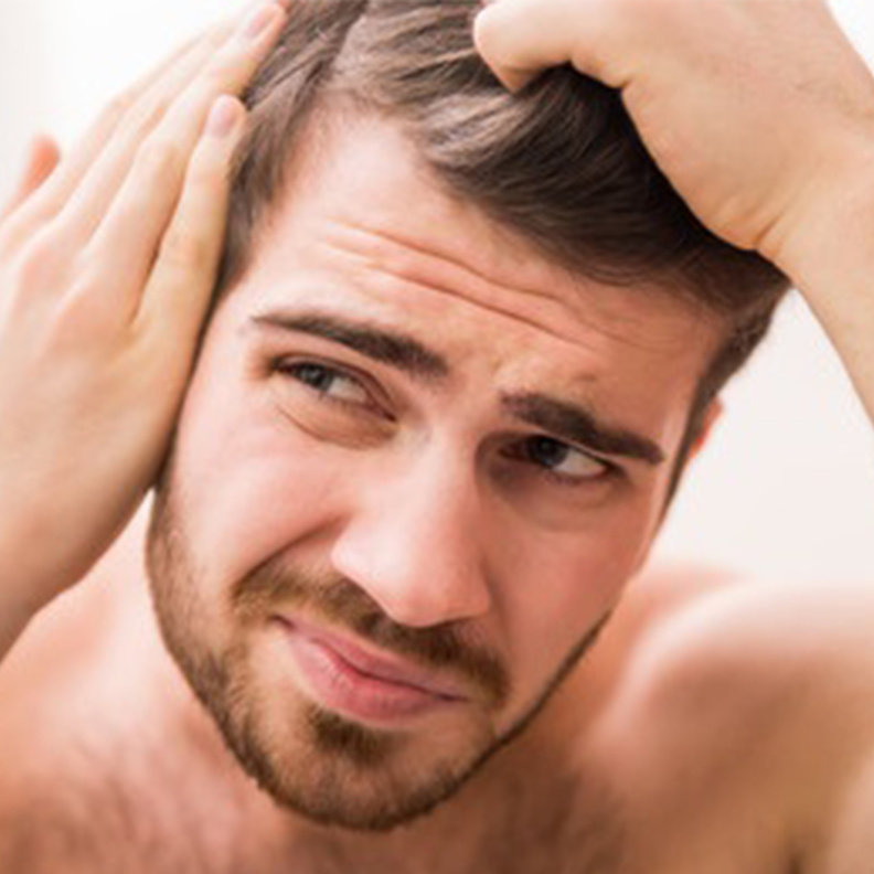 معلومات هامة عن الصلع عند الرجال