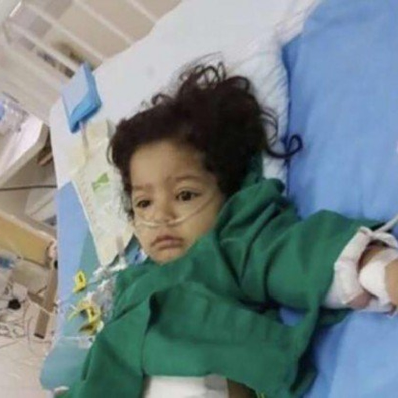 ممرضة سعودية تتبرع بكبدها لطفلة لا تعرفها