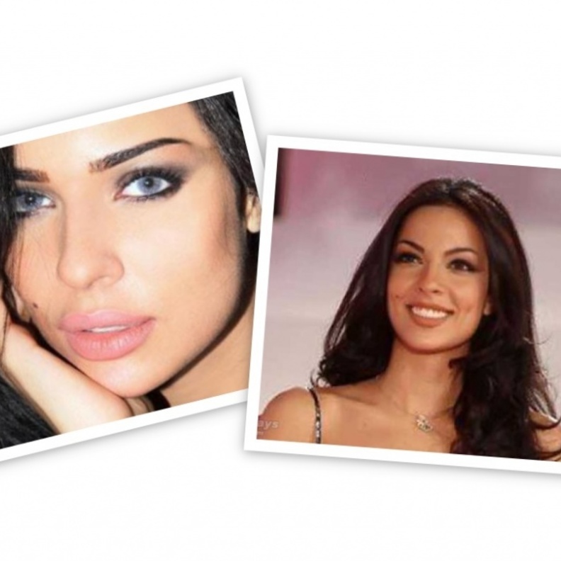  نادين نسيب نجيم وعملية تجميل للأنف