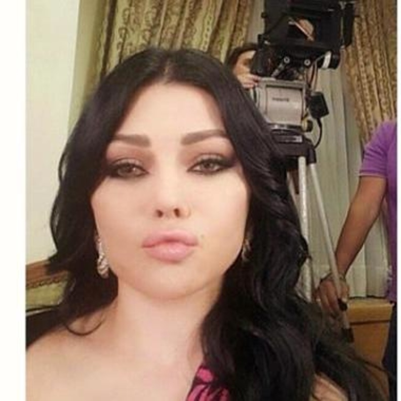  هيفاء وهبي بشفاه أكبر من قبل