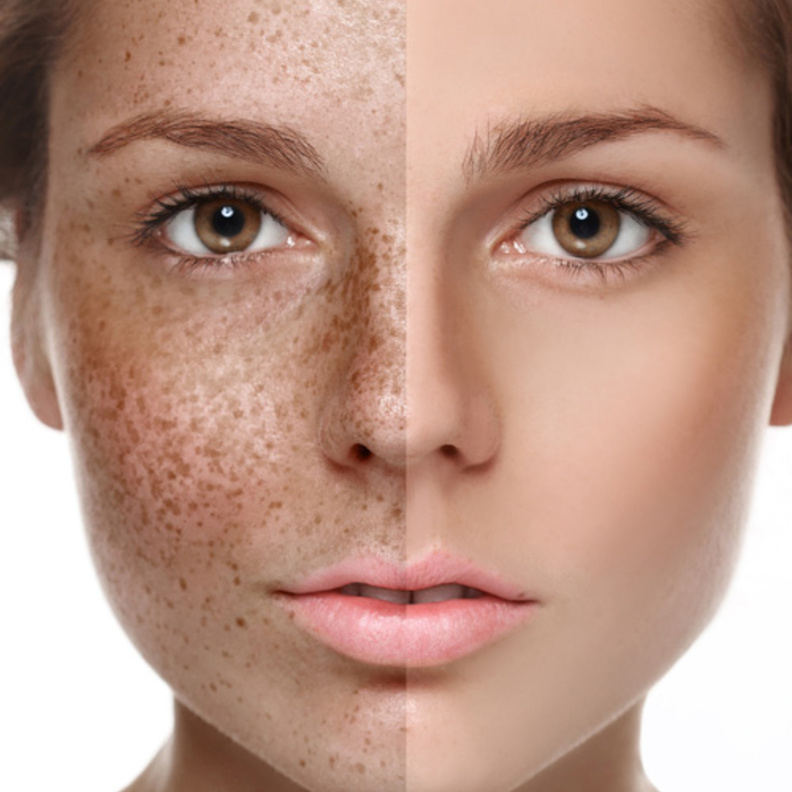 ملعقة من العسل مع الطحينة تعمل على نقاوة بشرتك