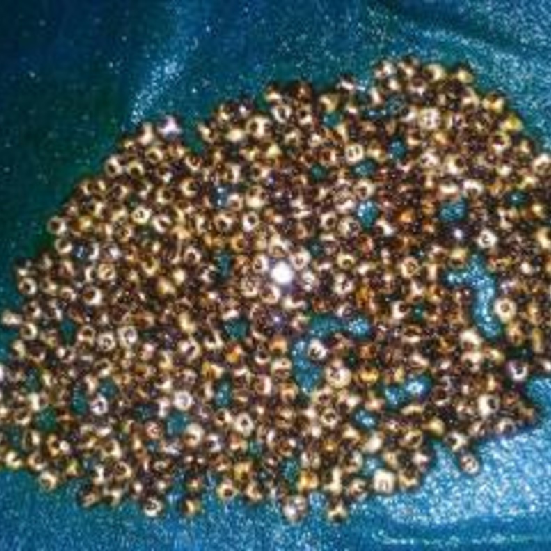 إزالة 360 حصاة مرارية من بطن إمرأة هندية  