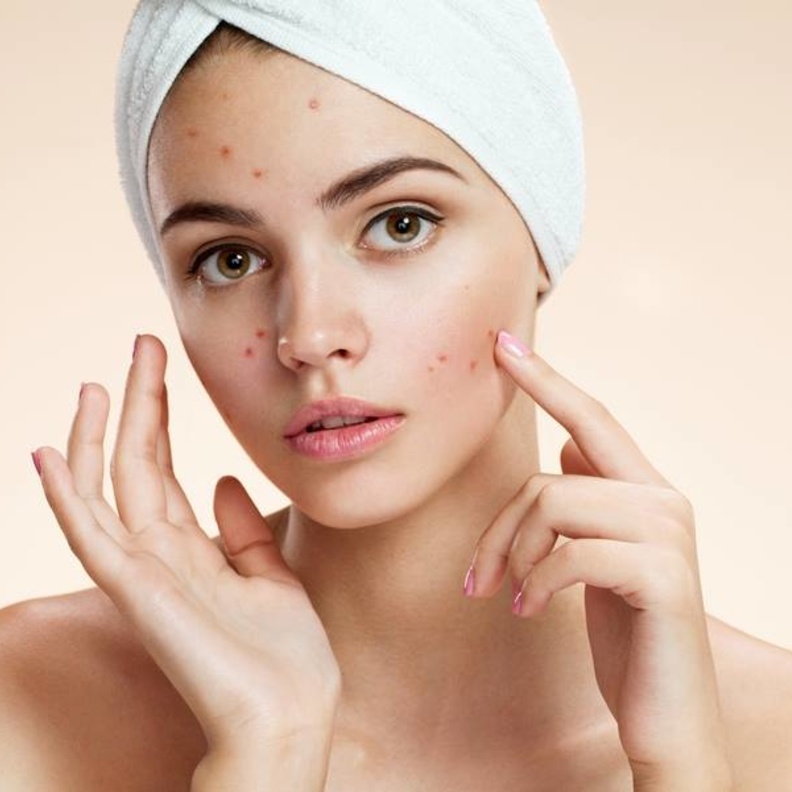 خبراء.. حب الشباب يسبب السرطان 