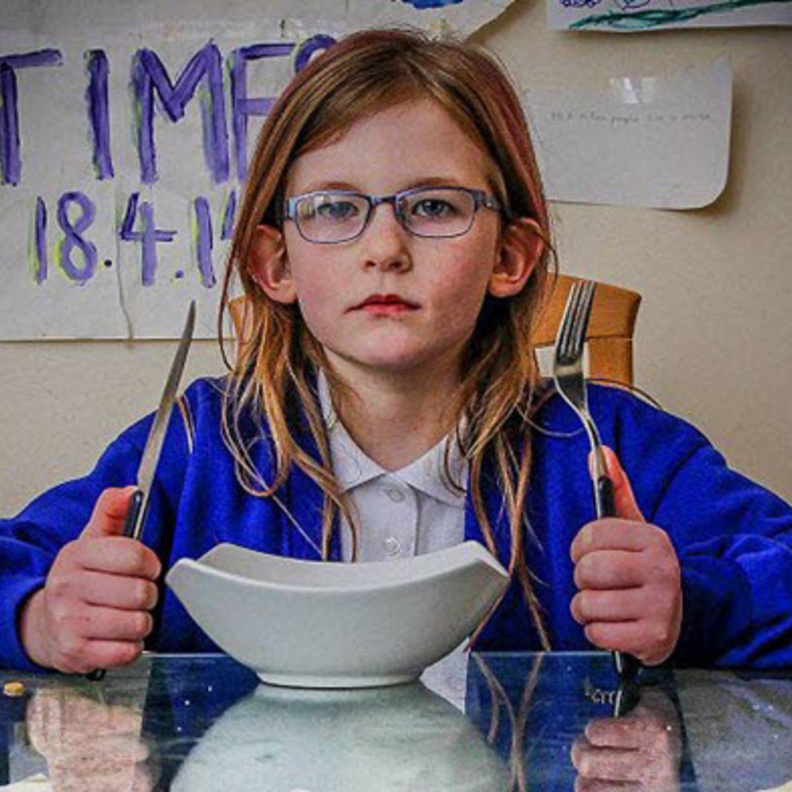 الطفلة أوليفيا تعاني من نقص الكرموزوم رقم 6