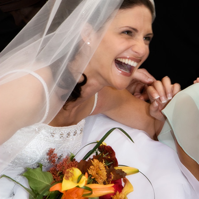 أسنان العروس... سر الابتسامة المشرقة