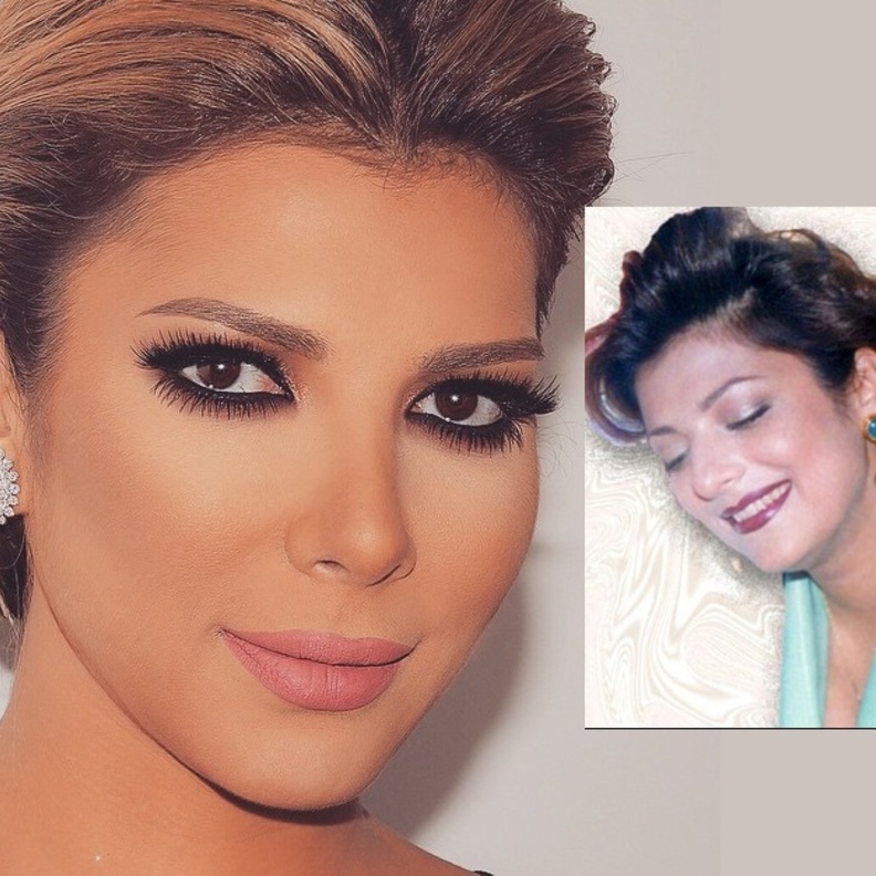 الفنانة السورية اصالة قبل وبعد تجميل الانف