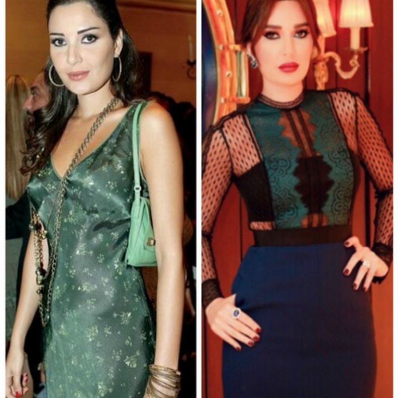 فرق شاسع باختياراتها للفساتين الملوّنة