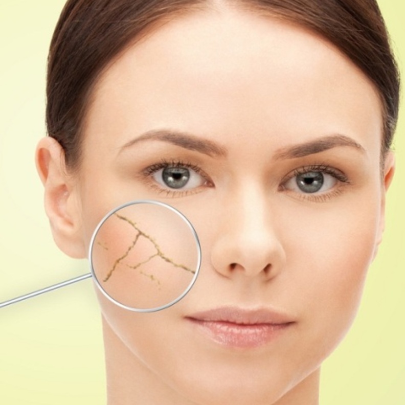 محارية جفاف البشرة