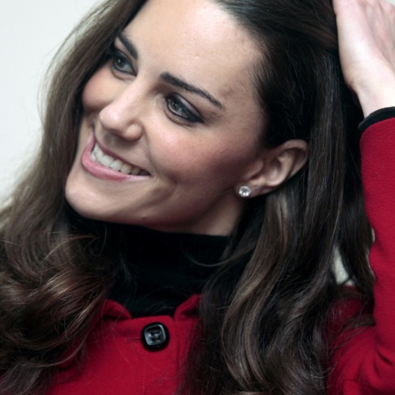 ندبة كبيرة على وجه كيت ميدلتون.. فما قصتها؟