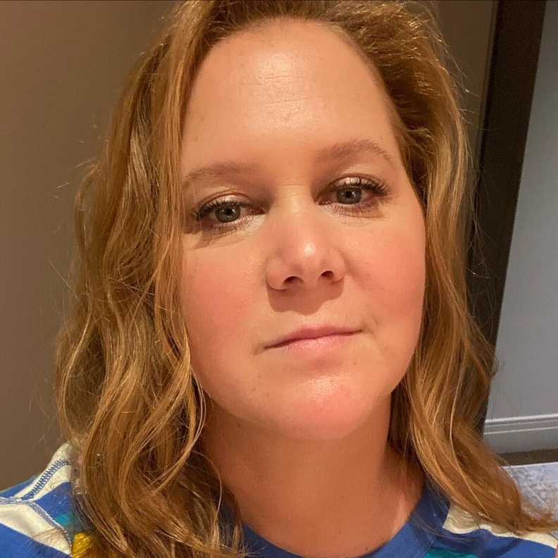 تفاصيل الحالة الصحية لـ"إيمي شومر" بعد خضوعها لعملية جراحية