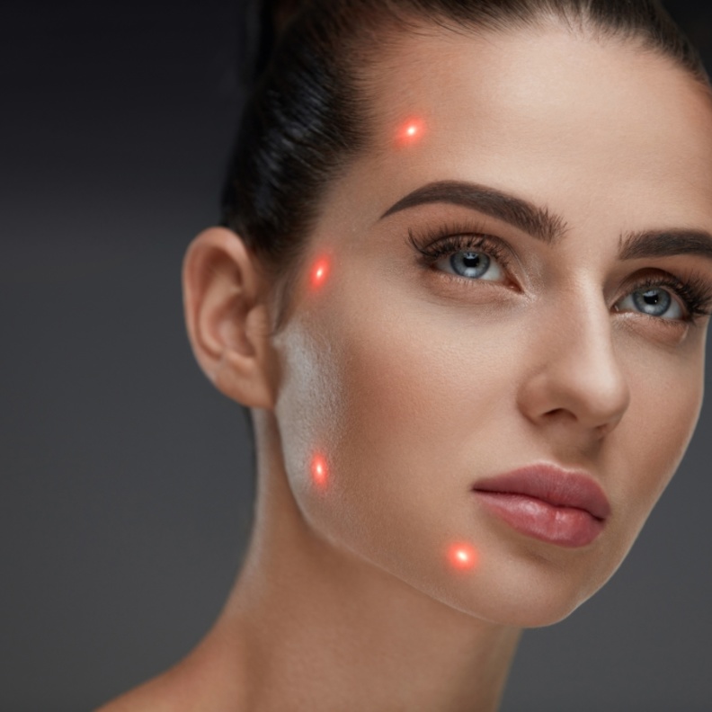  تفاصيل علاج احمرار البشرة بالليزر وما هي نتائجه