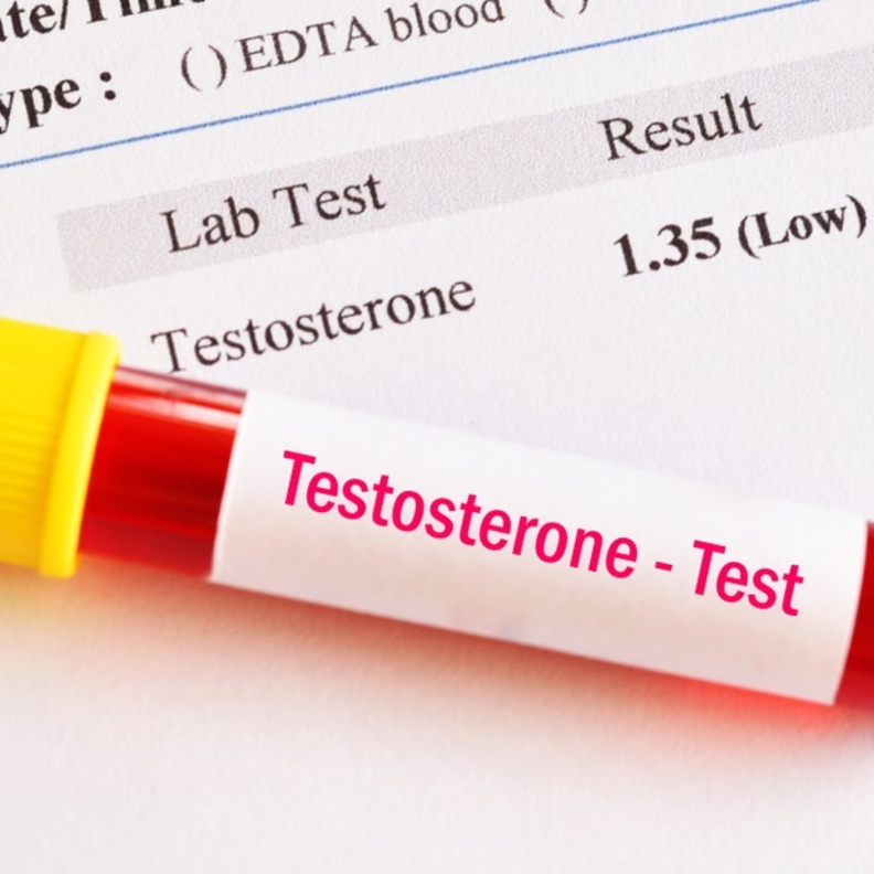 ما هي أعراض ارتفاع هرمون التستوستيرون عند النساء