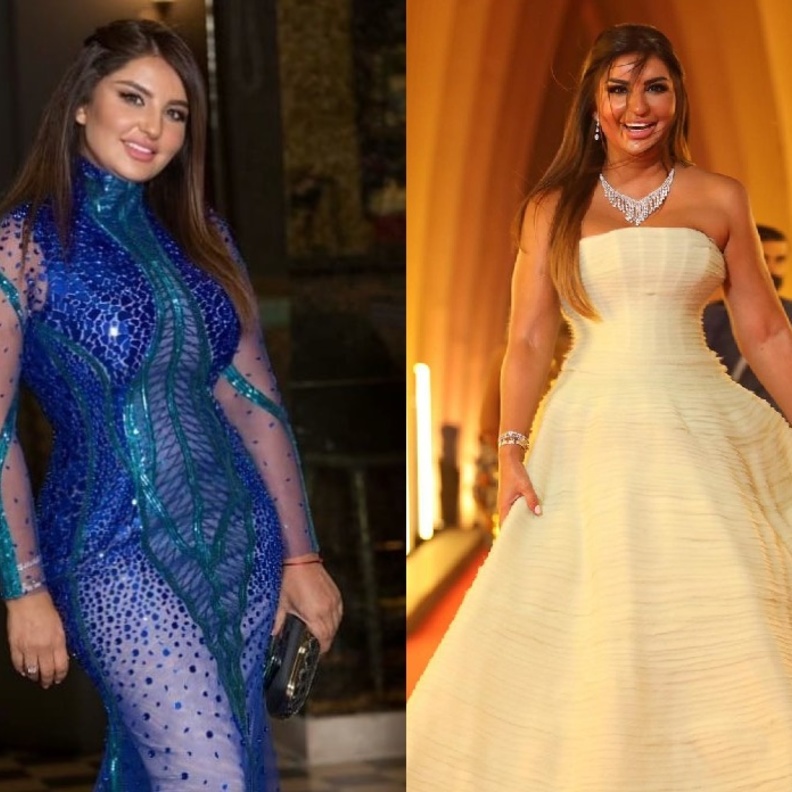 شذى حسون تصالح الجمهور بإطلالة مميزة بعد أزمة بطانة فستان حفل افتتاح الجونة