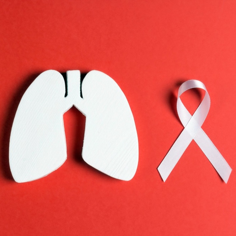 سرطان الرئة ذو نوعين ويمكن ان يؤدي للوفاة
