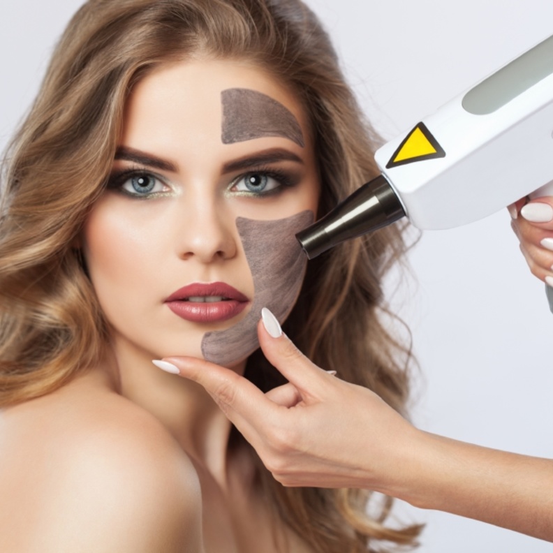 الليزر الكربوني للبشرة هو علاج مبتكر لإعادة تسطيح البشرة