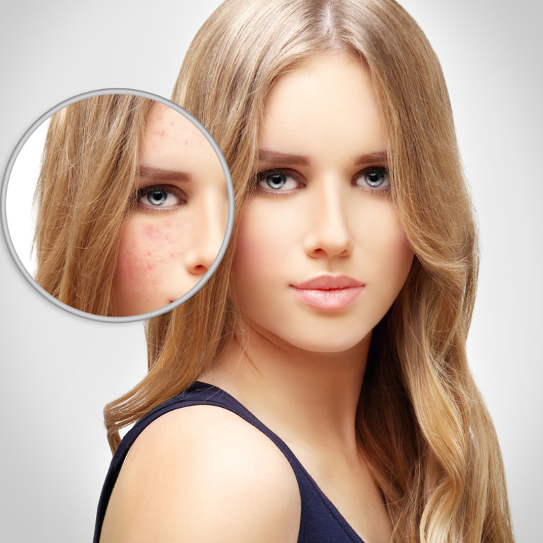 أفضل وصفات طبيعية لإزالة تصبغات الجلد