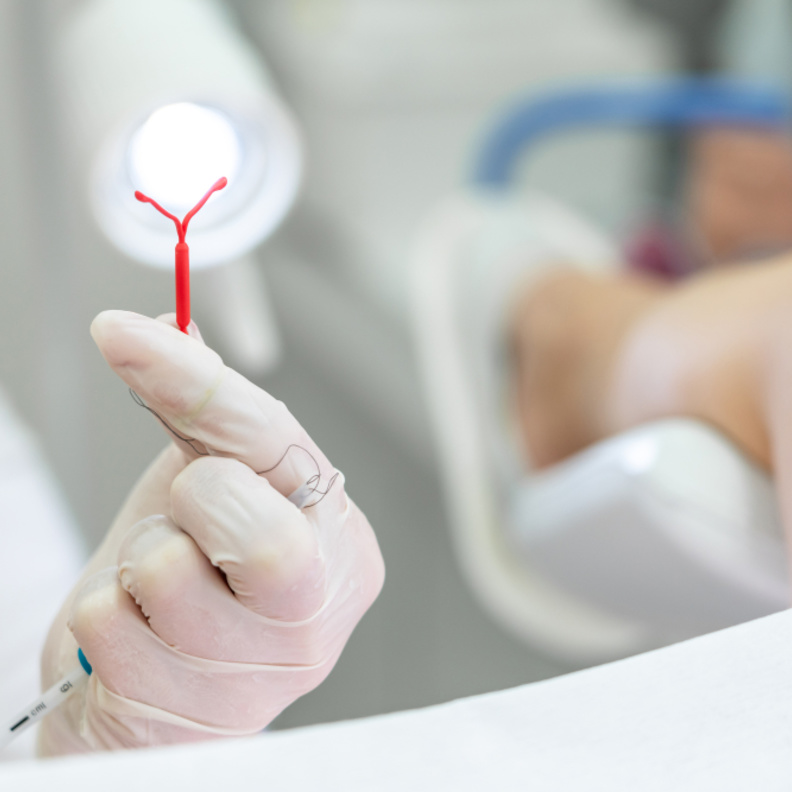 ما هو الوقت المثالي لإزالة اللولب عند رغبتك في حدوث الحمل