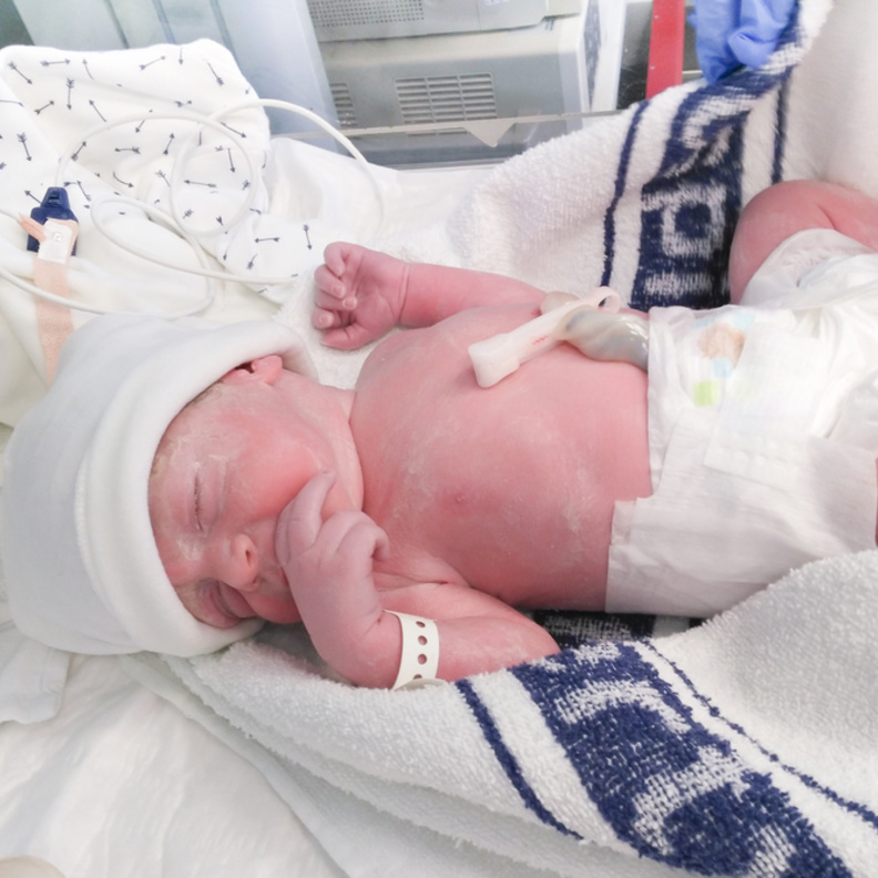 اضرار الولادة القيصرية على المدى البعيد قد تصيب الطفل بالربو والبدانة خلال مراحل نمو المتطورة